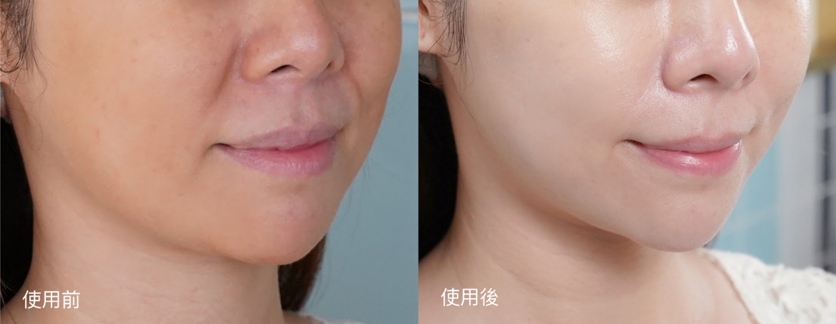 【讀者限定】無需打針！教你簡單步驟擁有逆齡彈滑水感肌